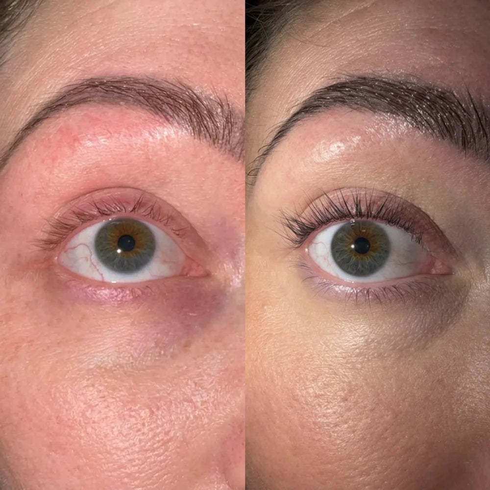 Lash Growth Serum™